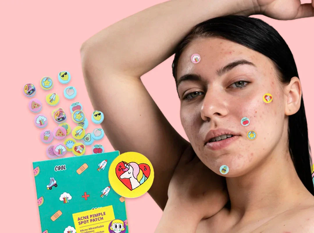 Parches para Acné: 3 Beneficios que Debes Conocer para Cuidar tu Piel
